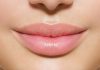 Elevate Your Beauty accompanying the Best Lip Fillers: Your Guide to Perfect Pout Enhancement